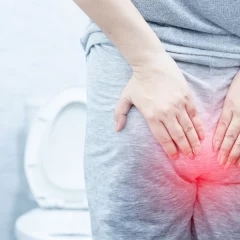 Fisura anal: causas, síntomas, diagnóstico y tratamiento